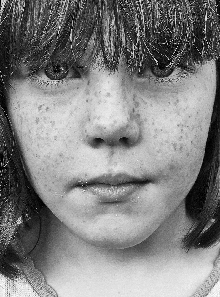 Apple_Frecklehead_Lotte_BW